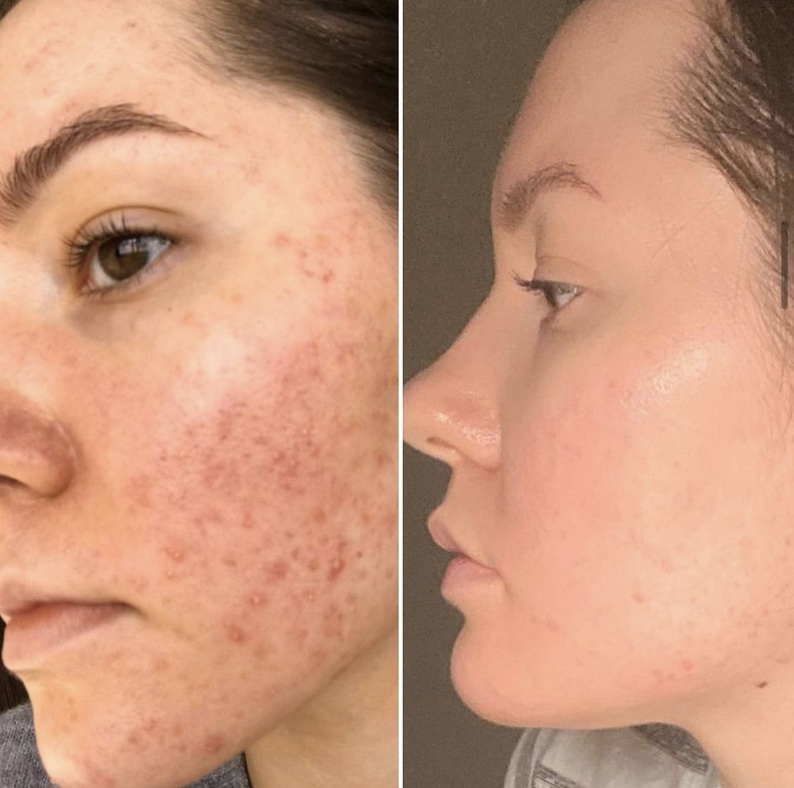 20% Vitamin C Brightening Serum