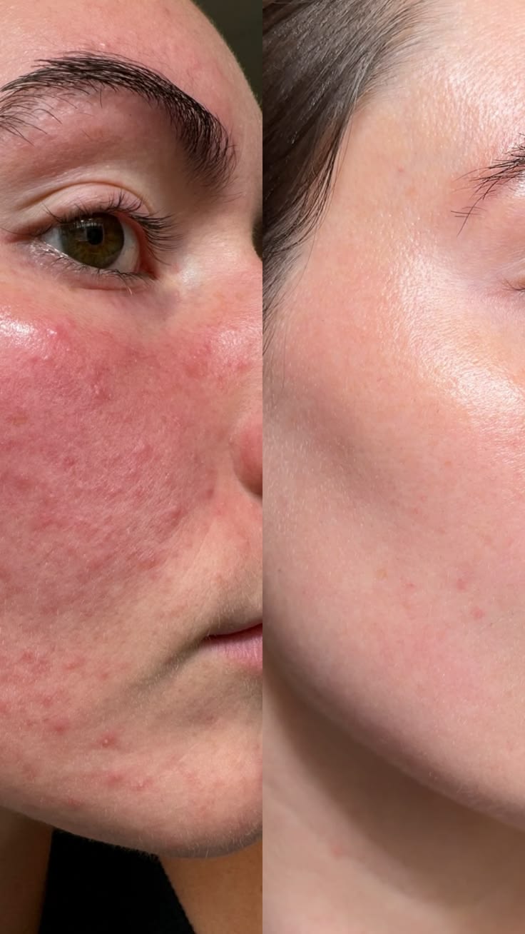 Far-Infrared & Red Light Facial Rejuvenation Device